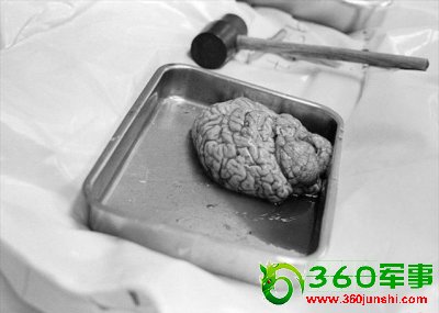 ʵ�ķ�ҽ����ʬ����ʵ����